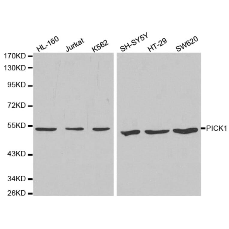 Western blot - PICK1 Antibody from Signalway Antibody (32296) - Antibodies.com