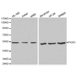 Western blot - PICK1 Antibody from Signalway Antibody (32296) - Antibodies.com