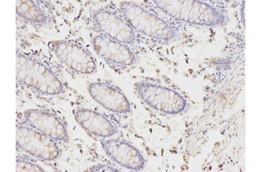 Immunohistochemistry - PICK1 Antibody from Signalway Antibody (32296) - Antibodies.com