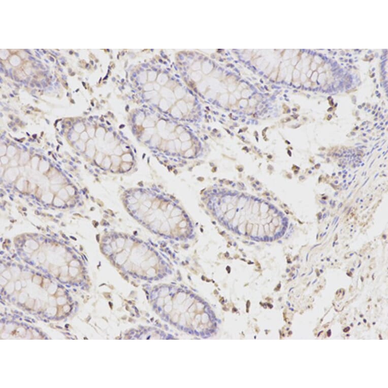 Immunohistochemistry - PICK1 Antibody from Signalway Antibody (32296) - Antibodies.com