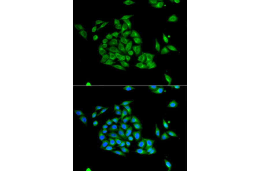 Immunofluorescence - PICK1 Antibody from Signalway Antibody (32296) - Antibodies.com