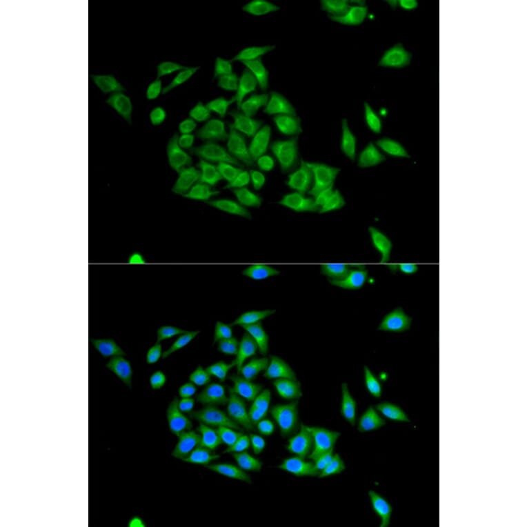 Immunofluorescence - PICK1 Antibody from Signalway Antibody (32296) - Antibodies.com