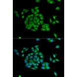 Immunofluorescence - PICK1 Antibody from Signalway Antibody (32296) - Antibodies.com