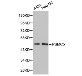 Western blot - PSMC5 Antibody from Signalway Antibody (32302) - Antibodies.com