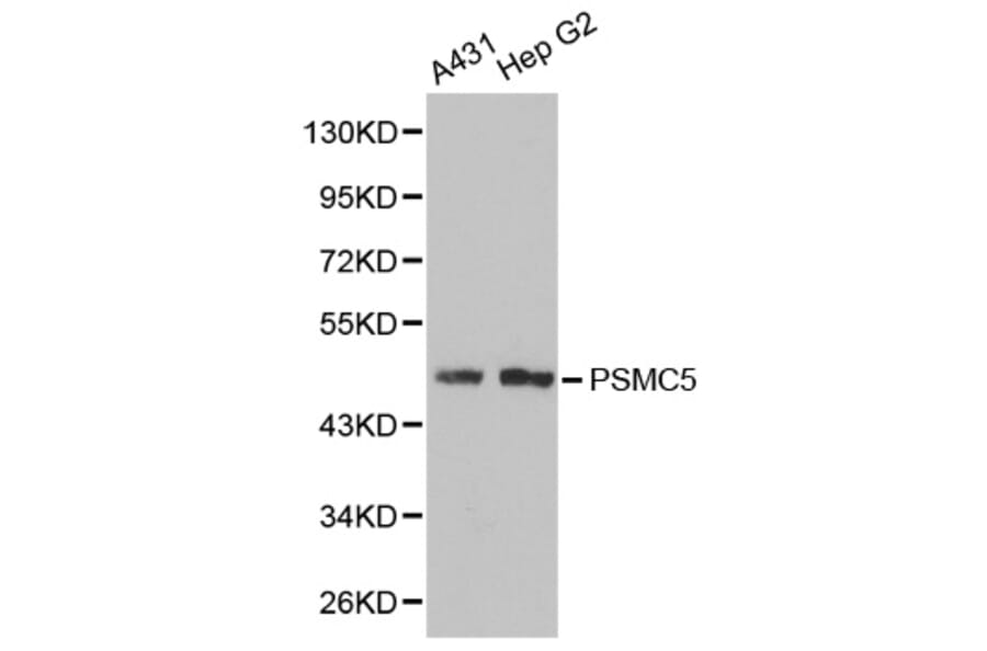 Western blot - PSMC5 Antibody from Signalway Antibody (32302) - Antibodies.com