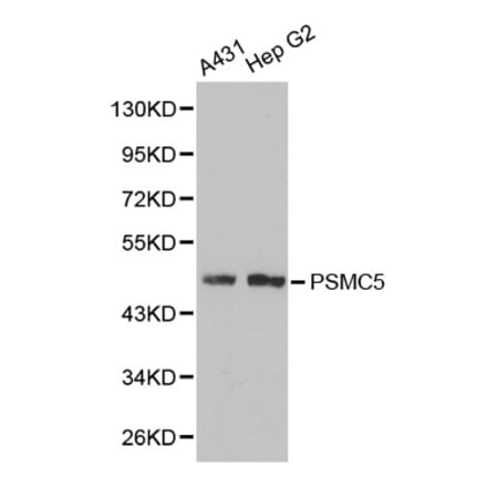 Western blot - PSMC5 Antibody from Signalway Antibody (32302) - Antibodies.com