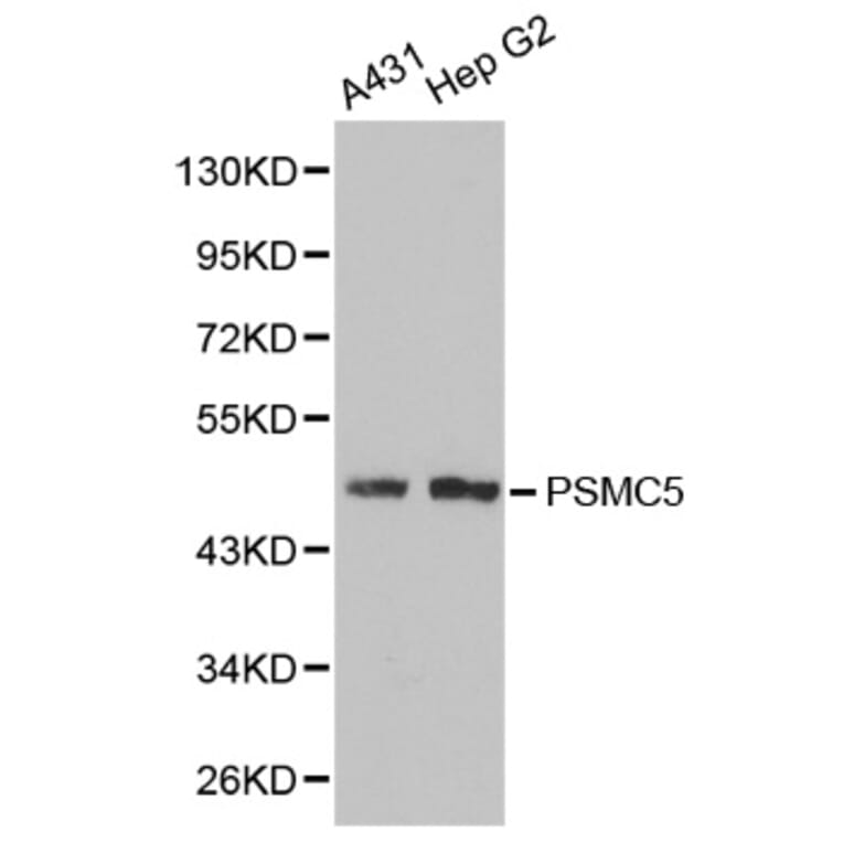 Western blot - PSMC5 Antibody from Signalway Antibody (32302) - Antibodies.com