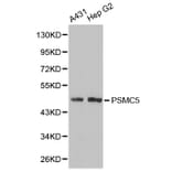 Western blot - PSMC5 Antibody from Signalway Antibody (32302) - Antibodies.com
