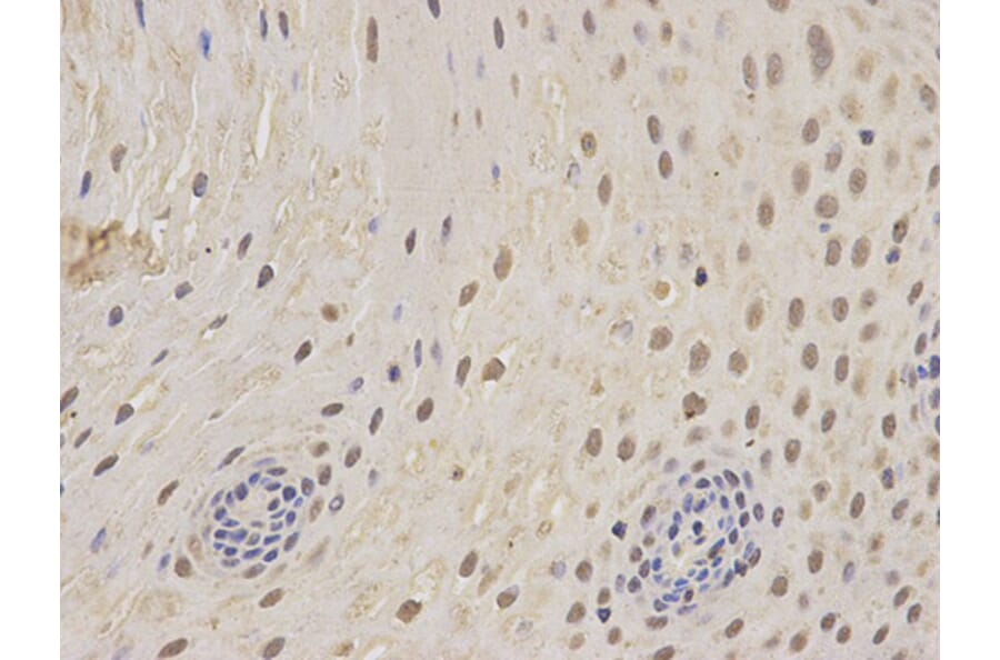 Immunohistochemistry - PSMC5 Antibody from Signalway Antibody (32302) - Antibodies.com