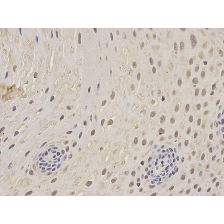 Immunohistochemistry - PSMC5 Antibody from Signalway Antibody (32302) - Antibodies.com