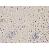 Immunohistochemistry - PSMC5 Antibody from Signalway Antibody (32302) - Antibodies.com