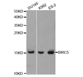 Western blot - BIRC5 Antibody from Signalway Antibody (32306) - Antibodies.com