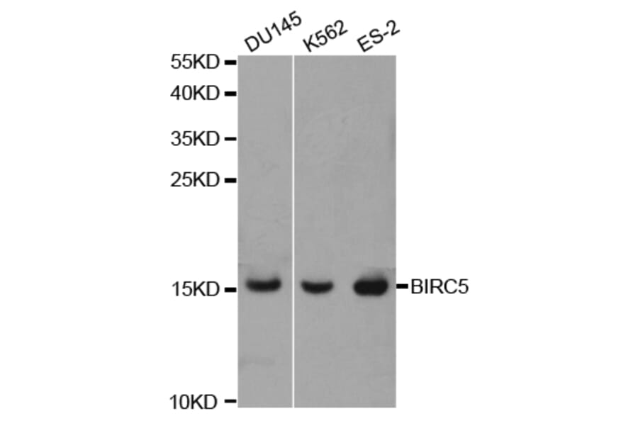 Western blot - BIRC5 Antibody from Signalway Antibody (32306) - Antibodies.com