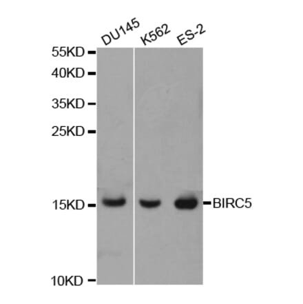 Western blot - BIRC5 Antibody from Signalway Antibody (32306) - Antibodies.com