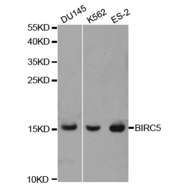 Western blot - BIRC5 Antibody from Signalway Antibody (32306) - Antibodies.com