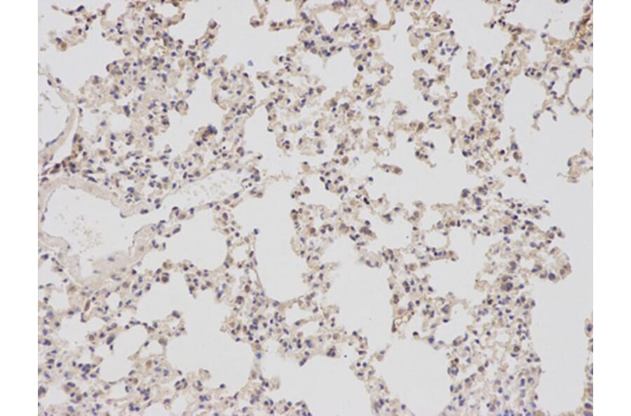 Immunohistochemistry - BIRC5 Antibody from Signalway Antibody (32306) - Antibodies.com