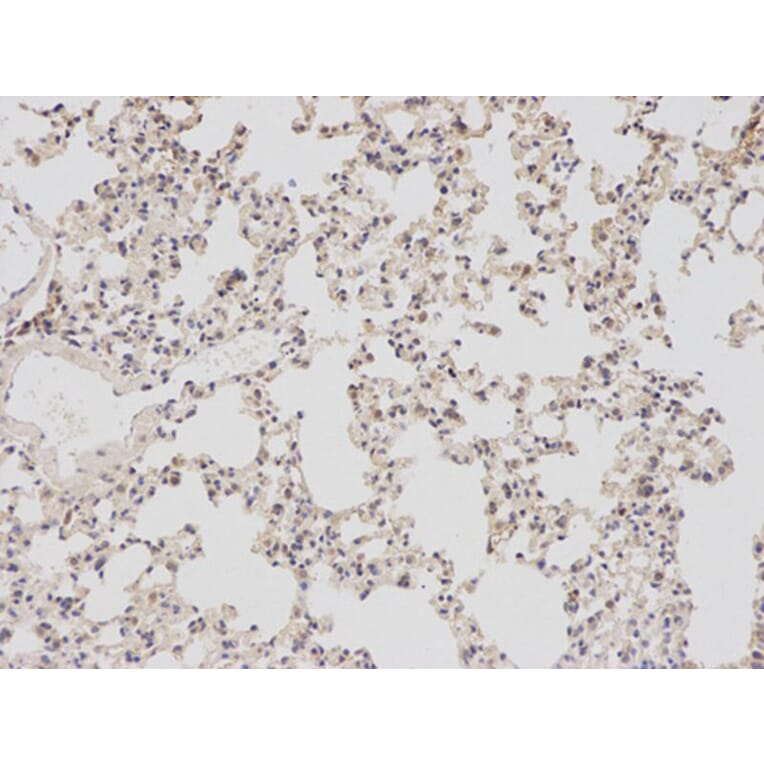 Immunohistochemistry - BIRC5 Antibody from Signalway Antibody (32306) - Antibodies.com