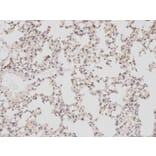 Immunohistochemistry - BIRC5 Antibody from Signalway Antibody (32306) - Antibodies.com