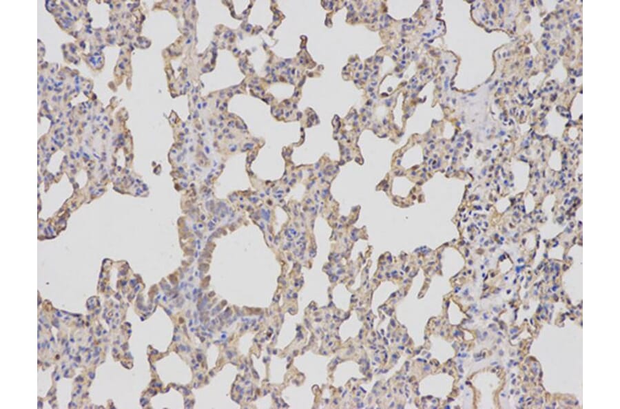 Immunohistochemistry - BIRC5 Antibody from Signalway Antibody (32306) - Antibodies.com