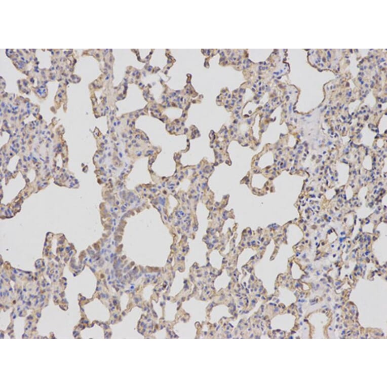 Immunohistochemistry - BIRC5 Antibody from Signalway Antibody (32306) - Antibodies.com