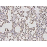 Immunohistochemistry - BIRC5 Antibody from Signalway Antibody (32306) - Antibodies.com
