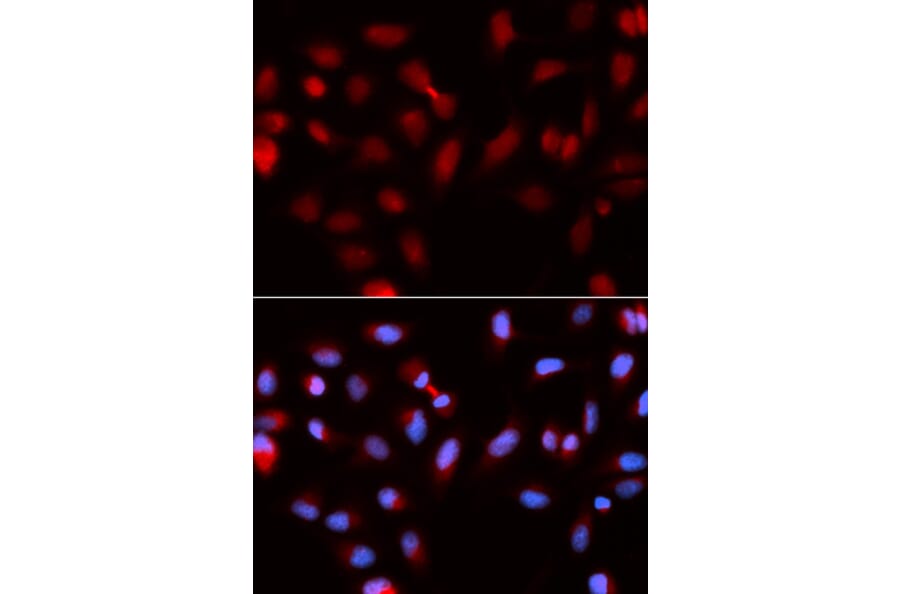 Immunofluorescence - BIRC5 Antibody from Signalway Antibody (32306) - Antibodies.com