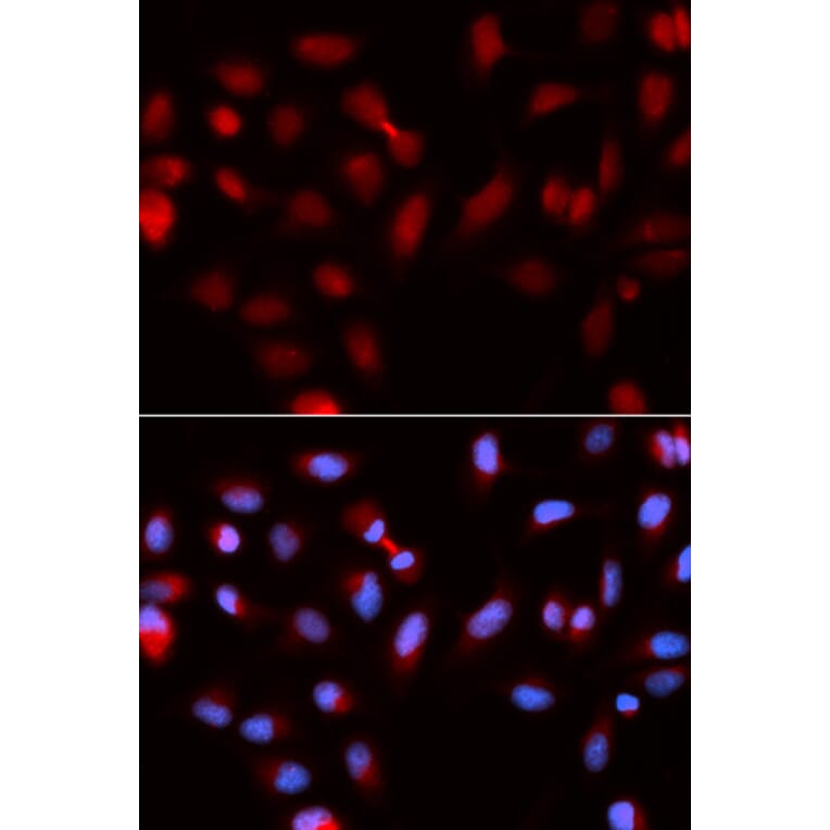 Immunofluorescence - BIRC5 Antibody from Signalway Antibody (32306) - Antibodies.com