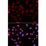 Immunofluorescence - BIRC5 Antibody from Signalway Antibody (32306) - Antibodies.com