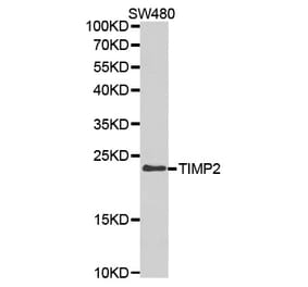 Western blot - TIMP2 Antibody from Signalway Antibody (32307) - Antibodies.com