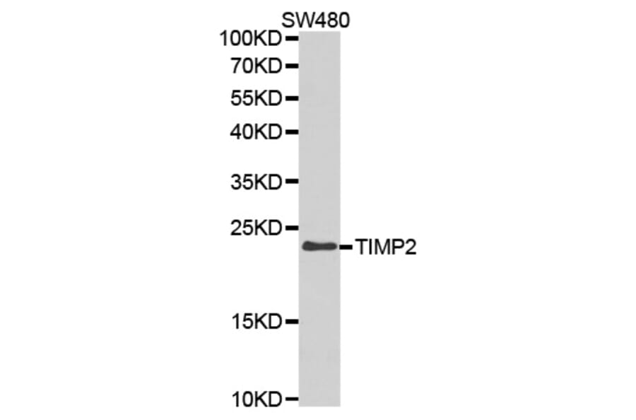 Western blot - TIMP2 Antibody from Signalway Antibody (32307) - Antibodies.com