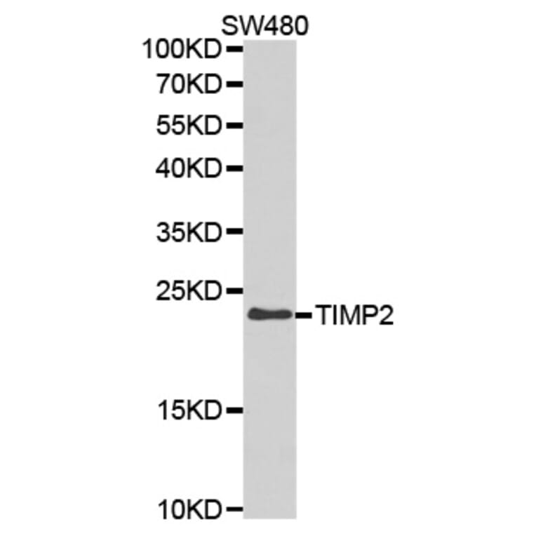 Western blot - TIMP2 Antibody from Signalway Antibody (32307) - Antibodies.com