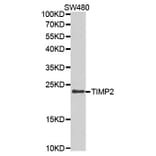 Western blot - TIMP2 Antibody from Signalway Antibody (32307) - Antibodies.com