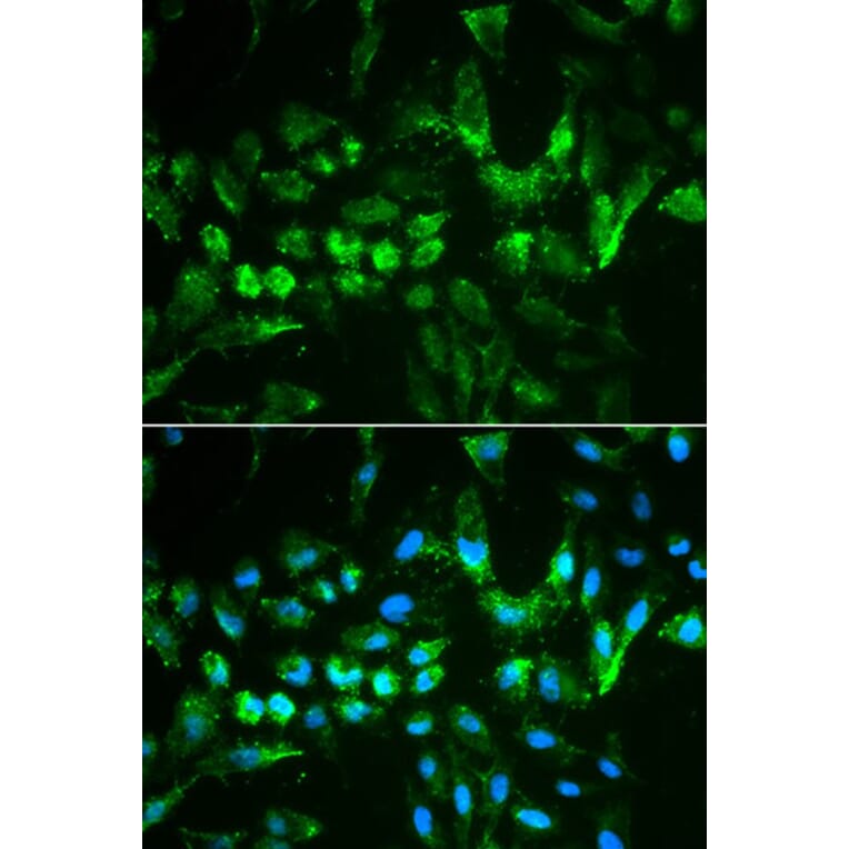 Immunofluorescence - TIMP2 Antibody from Signalway Antibody (32307) - Antibodies.com