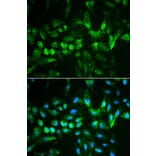 Immunofluorescence - TIMP2 Antibody from Signalway Antibody (32307) - Antibodies.com