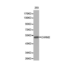 Western blot - CHRM2 Antibody from Signalway Antibody (32313) - Antibodies.com
