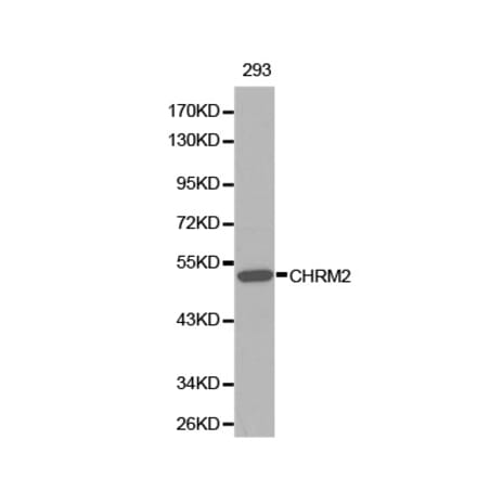 Western blot - CHRM2 Antibody from Signalway Antibody (32313) - Antibodies.com