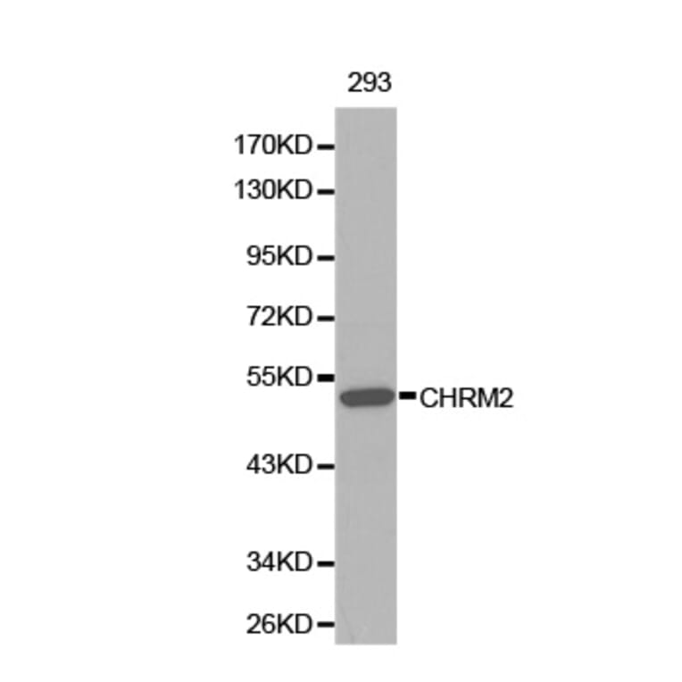 Western blot - CHRM2 Antibody from Signalway Antibody (32313) - Antibodies.com