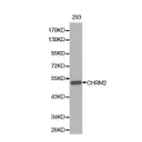 Western blot - CHRM2 Antibody from Signalway Antibody (32313) - Antibodies.com