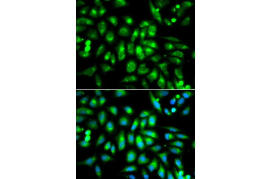 Immunofluorescence - CHRM2 Antibody from Signalway Antibody (32313) - Antibodies.com