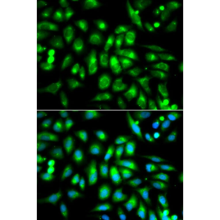 Immunofluorescence - CHRM2 Antibody from Signalway Antibody (32313) - Antibodies.com