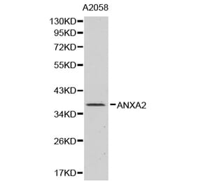 Western blot - ANXA2 Antibody from Signalway Antibody (32317) - Antibodies.com
