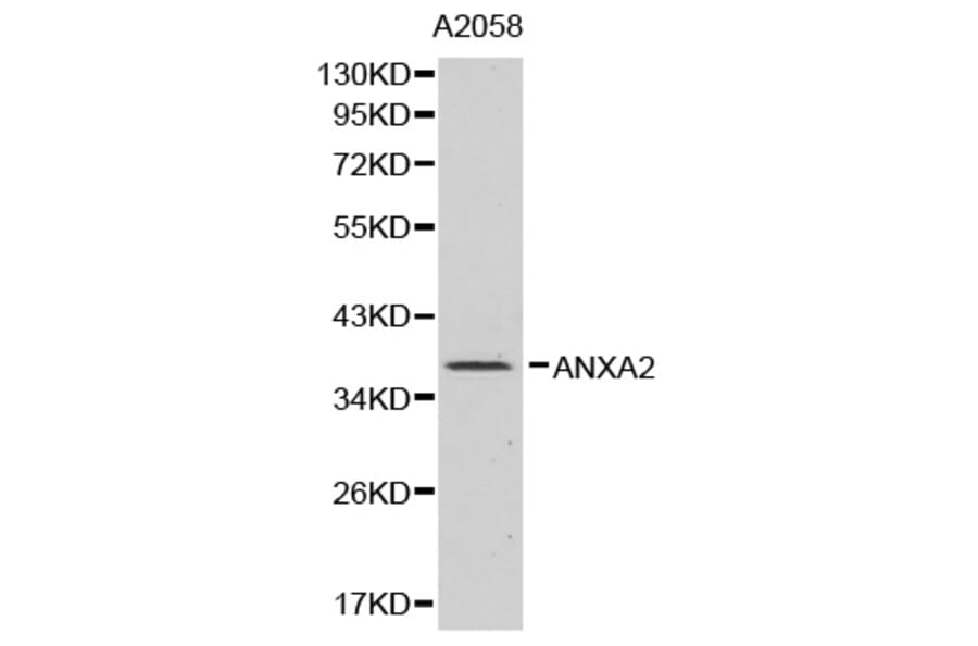 Western blot - ANXA2 Antibody from Signalway Antibody (32317) - Antibodies.com