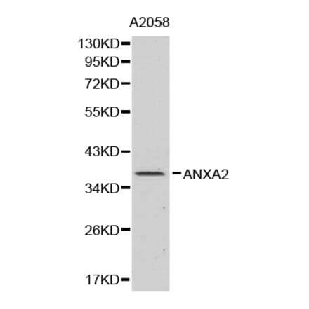 Western blot - ANXA2 Antibody from Signalway Antibody (32317) - Antibodies.com