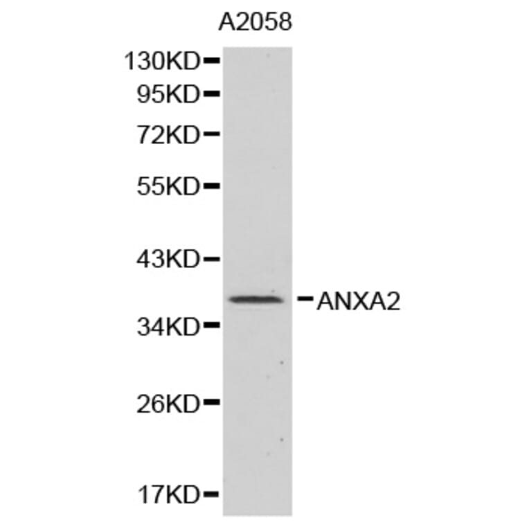 Western blot - ANXA2 Antibody from Signalway Antibody (32317) - Antibodies.com