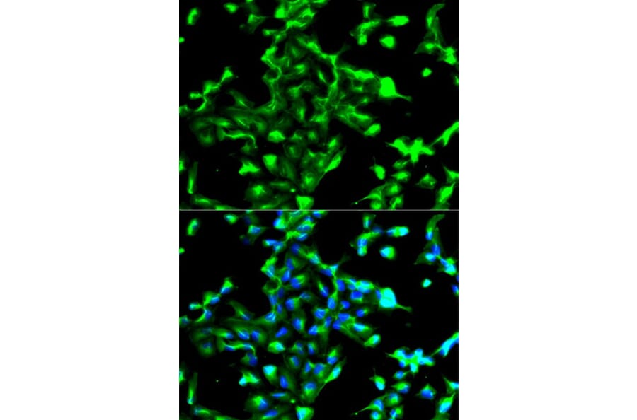 Immunofluorescence - ANXA2 Antibody from Signalway Antibody (32317) - Antibodies.com