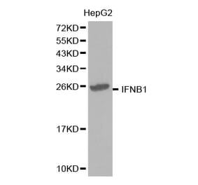 Western blot - IFNB1 Antibody from Signalway Antibody (32320) - Antibodies.com