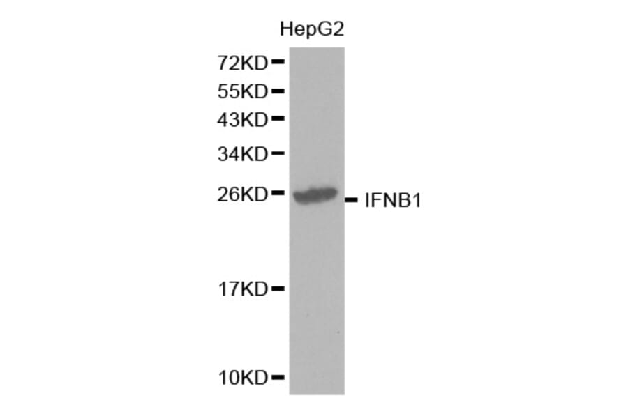 Western blot - IFNB1 Antibody from Signalway Antibody (32320) - Antibodies.com
