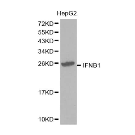 Western blot - IFNB1 Antibody from Signalway Antibody (32320) - Antibodies.com