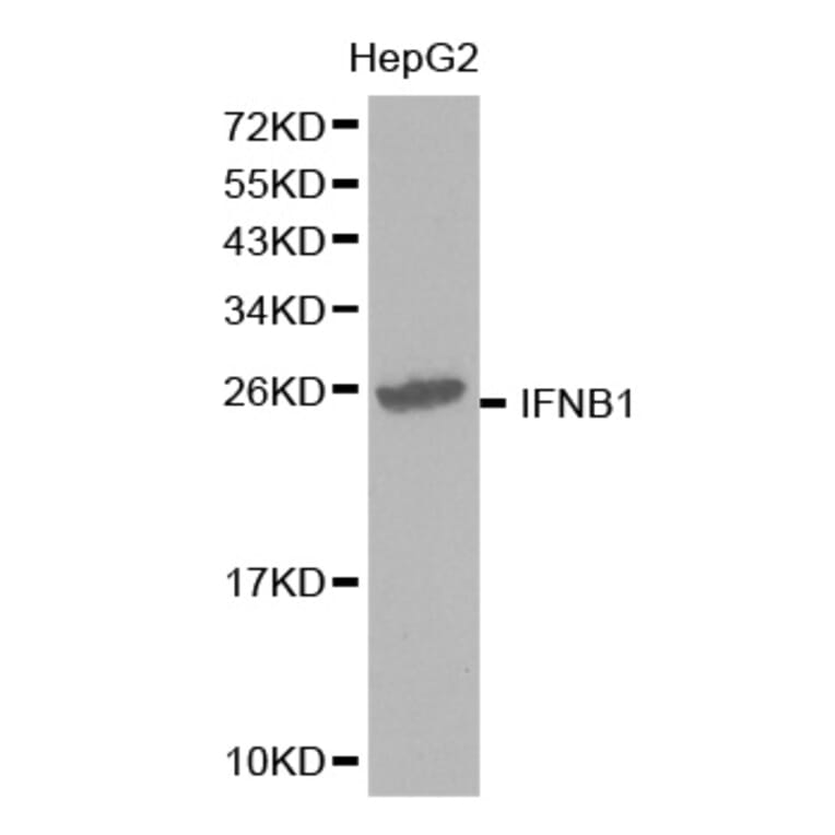 Western blot - IFNB1 Antibody from Signalway Antibody (32320) - Antibodies.com