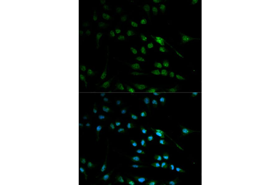Immunofluorescence - IFNB1 Antibody from Signalway Antibody (32320) - Antibodies.com
